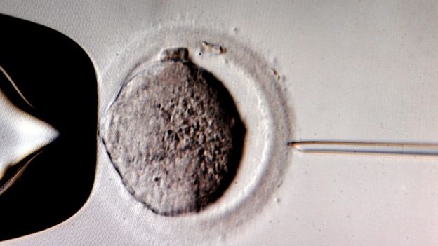Une micro-injection de spermatozoïdes dans une cellule