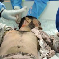 Un Libyen blessé (image d'illustration)