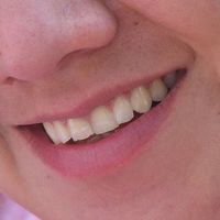 Des scientifiques japonais ont trouvé un moyen de vous donner un sourire éclatant